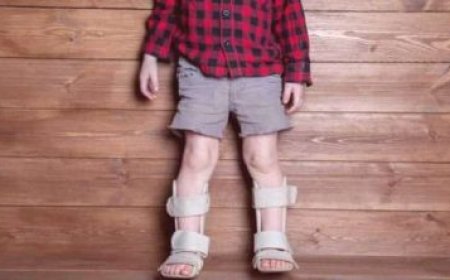 نقص فيتامين د عند الأطفال.. خطر صامت يهدد صحة العظام والنمو