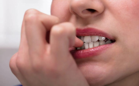 عادة قضم الأظافر… أكثر من مجرد سلوك عابر!