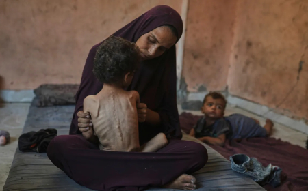 أزمة المجاعة تتفاقم في غزة: ارتفاع عدد الضحايا إلى 193 بينهم 96 طفلًا