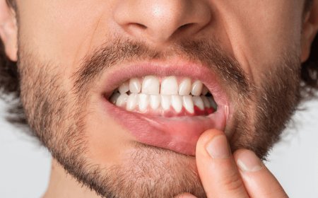 إلتهاب اللثة.. خطر صامت قد يصل إلى القلب