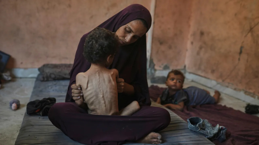أزمة المجاعة تتفاقم في غزة: ارتفاع عدد الضحايا إلى 193 بينهم 96 طفلًا