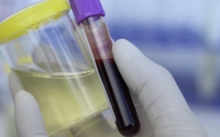 تحليل مرض السكري: كيف تعرف أنك معرض للخطر وما هي التحاليل اللازمة؟