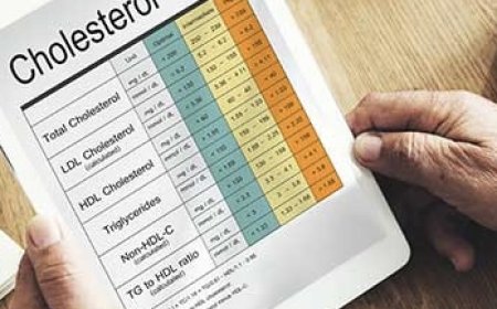 تحليل الكوليسترول.. مفتاحك لفهم صحة قلبك قبل فوات الأوان
