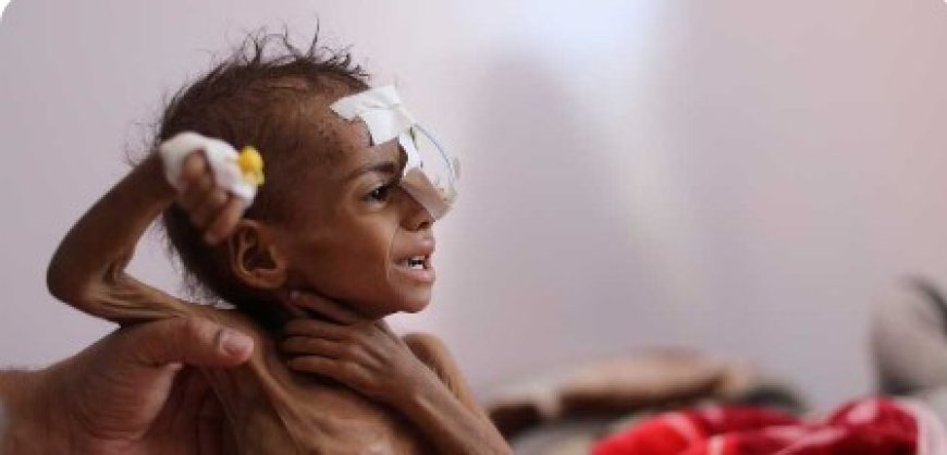 تقرير أممي: 18.1 مليون يمني على حافة الجوع و41 ألفًا مهددون بالمجاعة