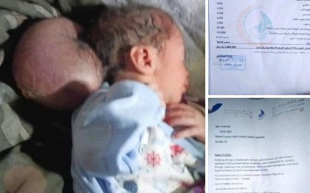 يتطلب تدخل جراحي عاجل .. مناشدة عاجلة لإنقاذ حياة طفل مولود