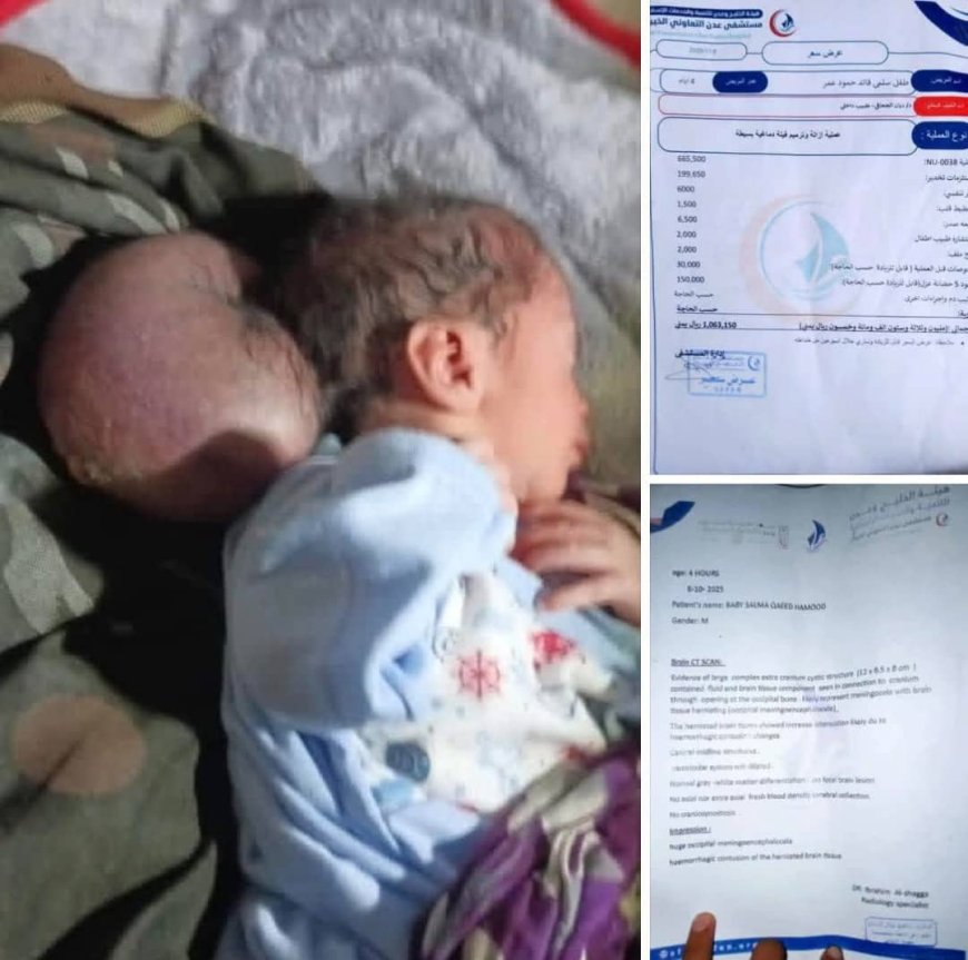 يتطلب تدخل جراحي عاجل .. مناشدة عاجلة لإنقاذ حياة طفل مولود