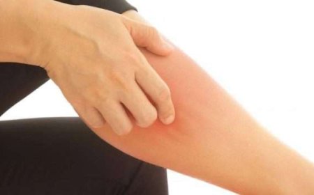 التهاب النسيج الخلوي.. عدوى جلدية شائعة قد تتحول إلى خطر يهدد الحياة إذا أُهملت