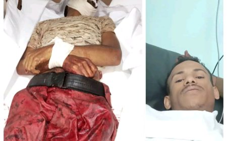 الضالع: القوات الجنوبية تحبط هجومًا حوثيًا شرسًا وتكبده خسائر كبيرة، فيما ارتقى شهيد وأصيب آخر من ابطالها 