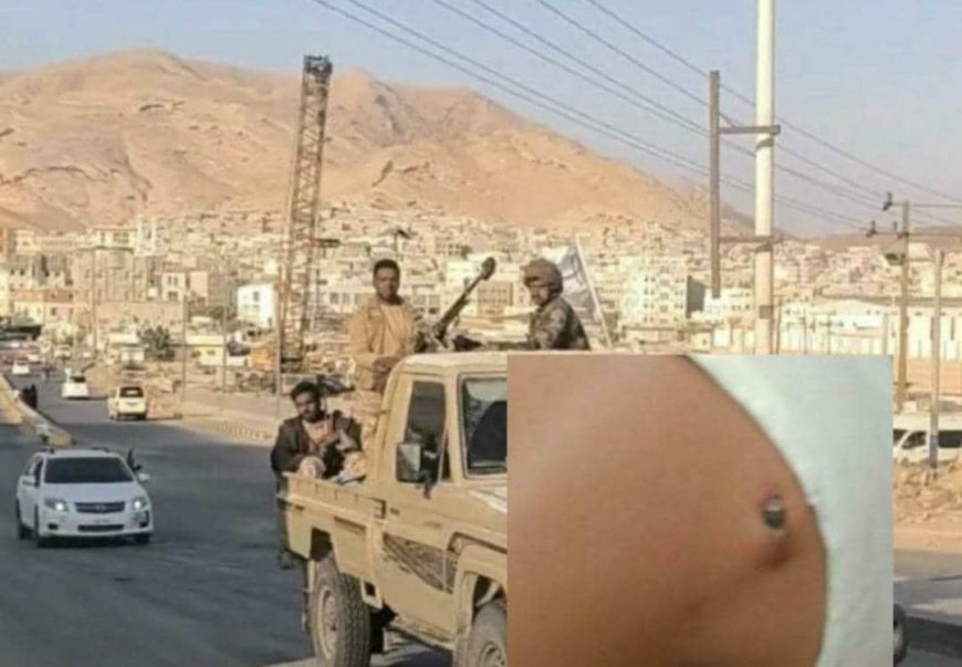 رصاص موكب بن حبريش الراجع يجرح شابا ويعري واقع الفوضى في المكلا